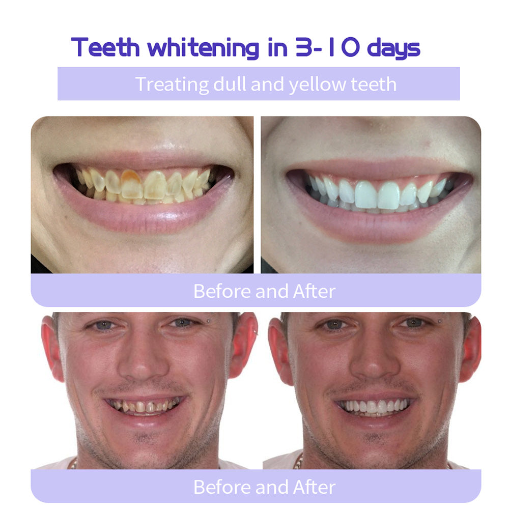 DENTORA WHITE™ Teeth Restoration Mineral Powder🦷(TGA recommended)