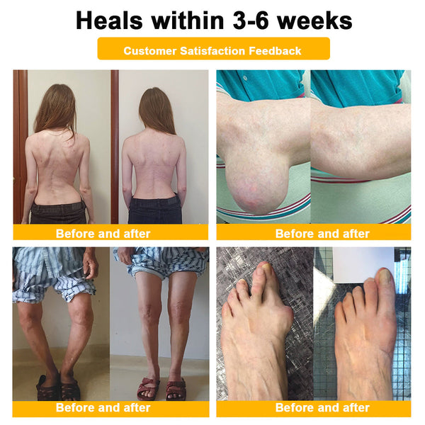 🎁Flash Sale - DENTORA WHITE™ Botulinum Toxin & Bee Venom Pain-Relief Bone Healing Cream🐝💎